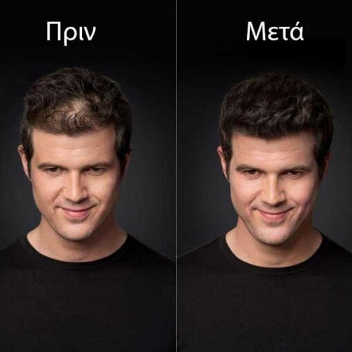 Toppik Προϊόν Πύκνωσης Μαλλιών Μαύρο - Black 144gr - Image 3